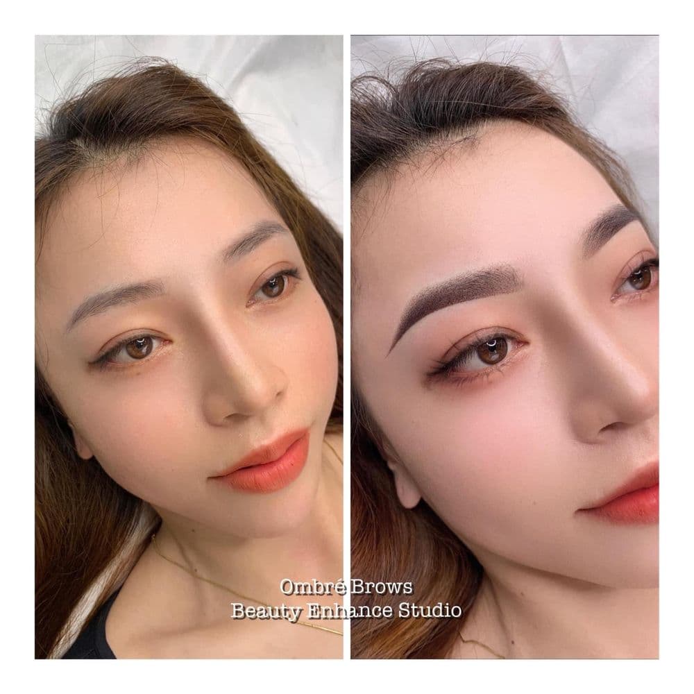 Beauty Enhance - Rockville - hair transplant in Potomac, MD