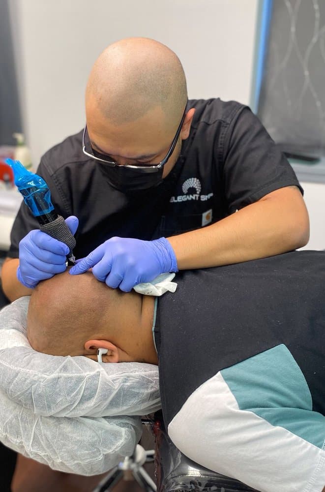 Elegant Scalp Micropigmentation - hair transplant in Orchard Park, NY