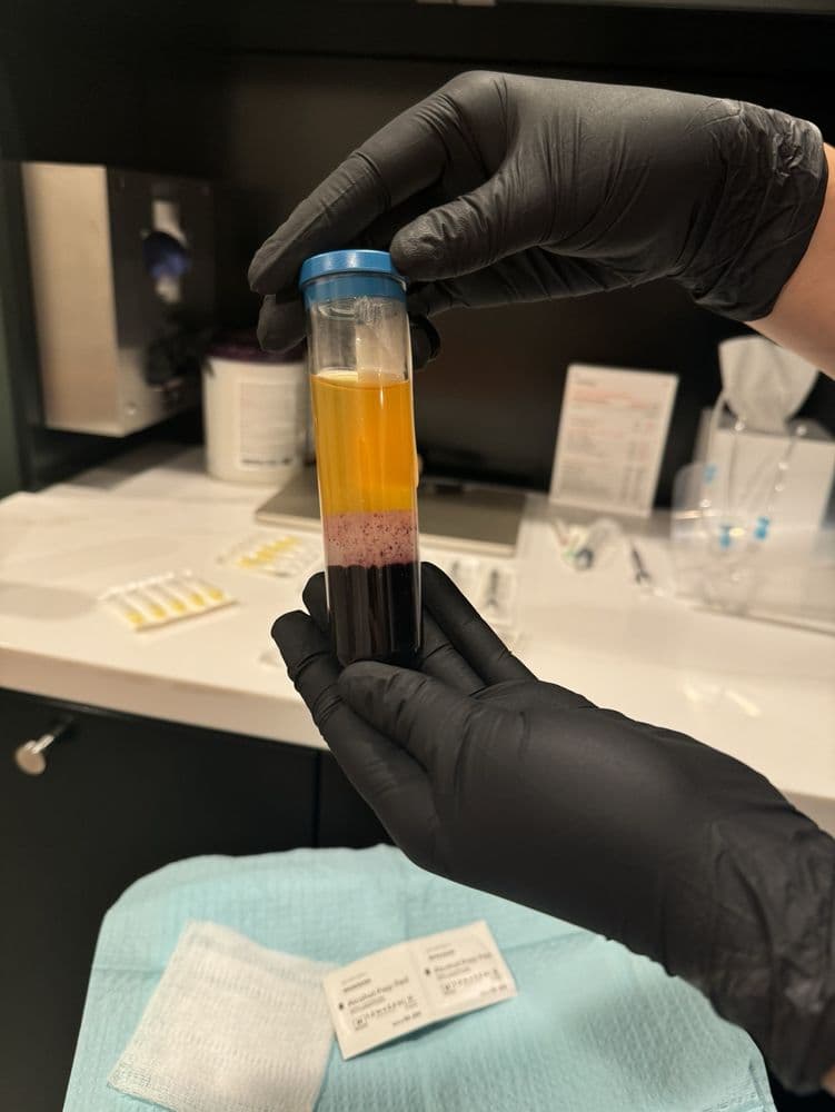 Great Many - hair transplant in New York, NY