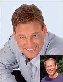 Natural Image Hair Group - hair transplant in Mamaroneck, NY