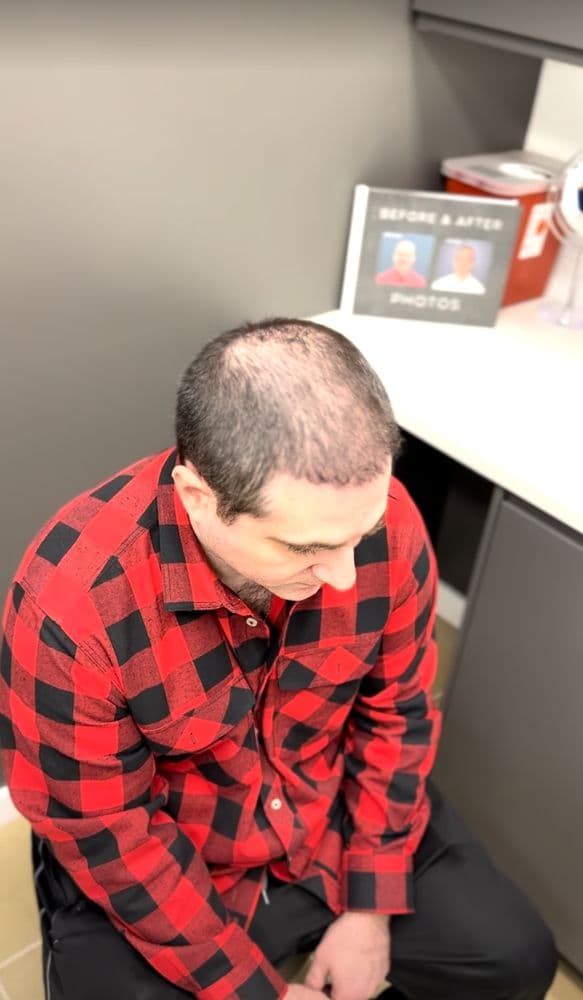 Nova Medical Hair Transplant - hair transplant in Philadelphia, PA