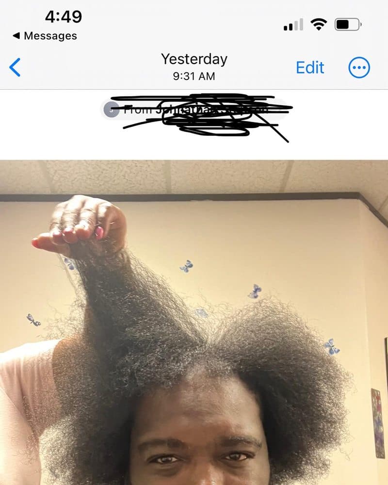 Emma Rose Natural Hair - hair transplant in Houston, TX