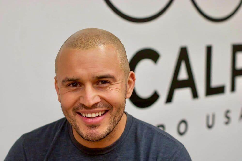 Scalp Micro USA - hair transplant in New York, NY