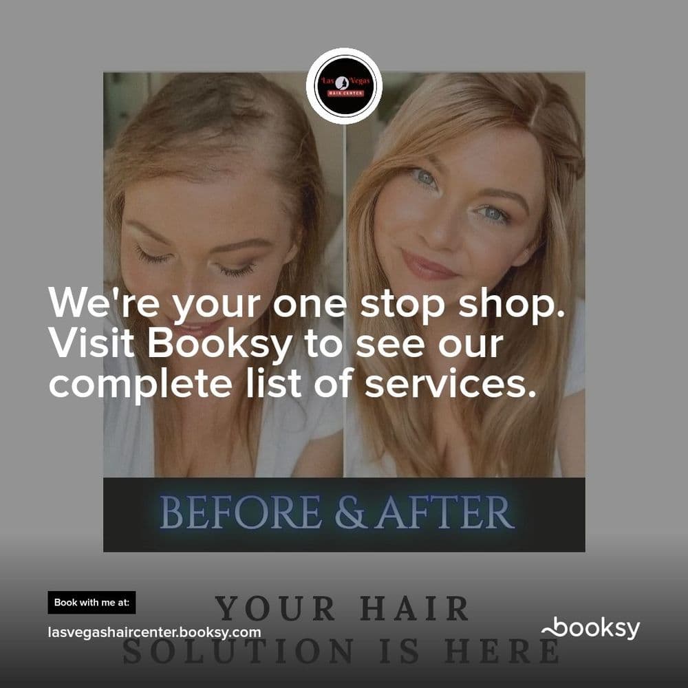 Las Vegas Hair Center - hair transplant in Las Vegas, NV