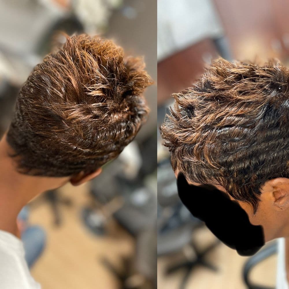 Salon Hair Loss Solutions - hair transplant in Lilburn, GA