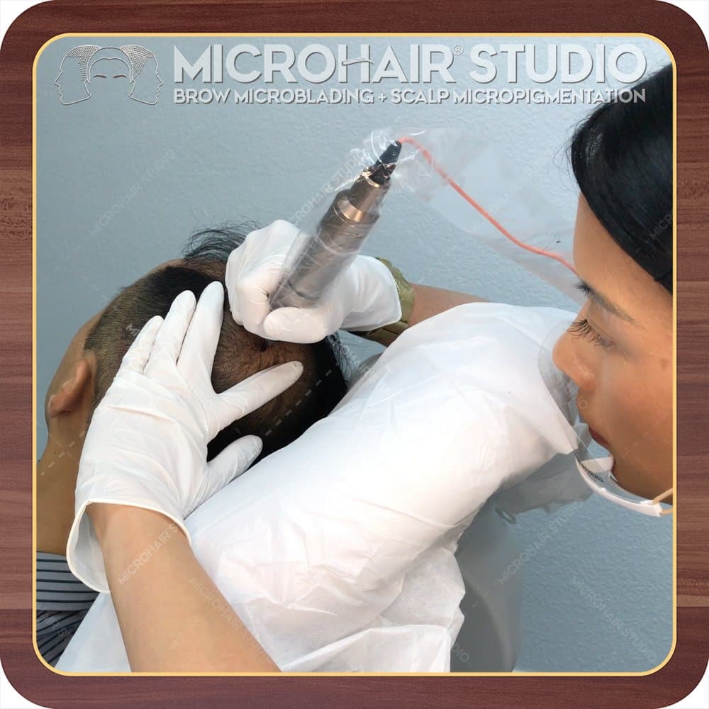Microhair Studio - hair transplant in Milpitas, CA