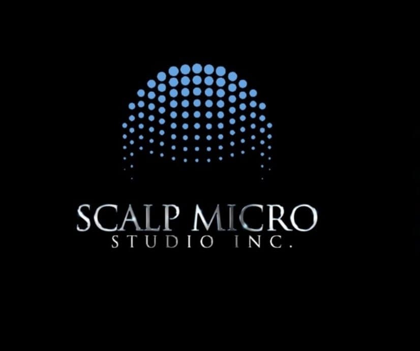 Scalp Micro Studio - hair transplant in Atlanta, GA