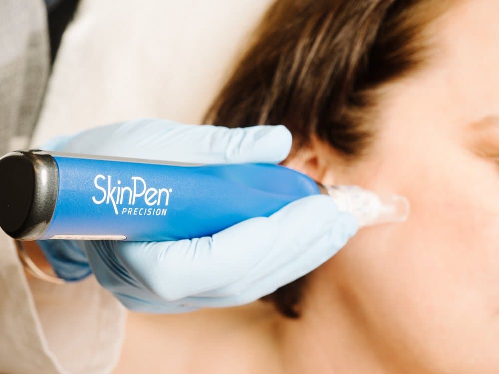 Debbie Russell Aesthetics - hair transplant in Montgomery, AL