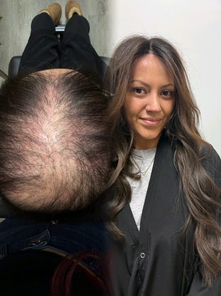 Kindred Hair Salon - Summerlin - hair transplant in Las Vegas, NV