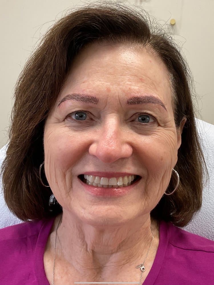 Bella Beauty - hair transplant in Baton Rouge, LA