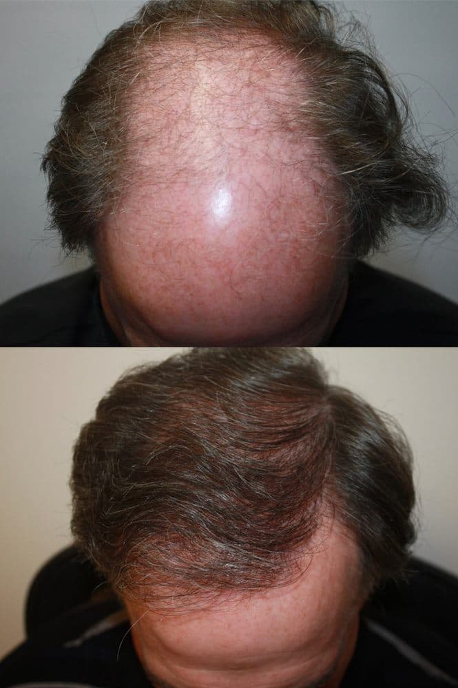 Rosanelli Medical Associates - hair transplant in Campbell, CA
