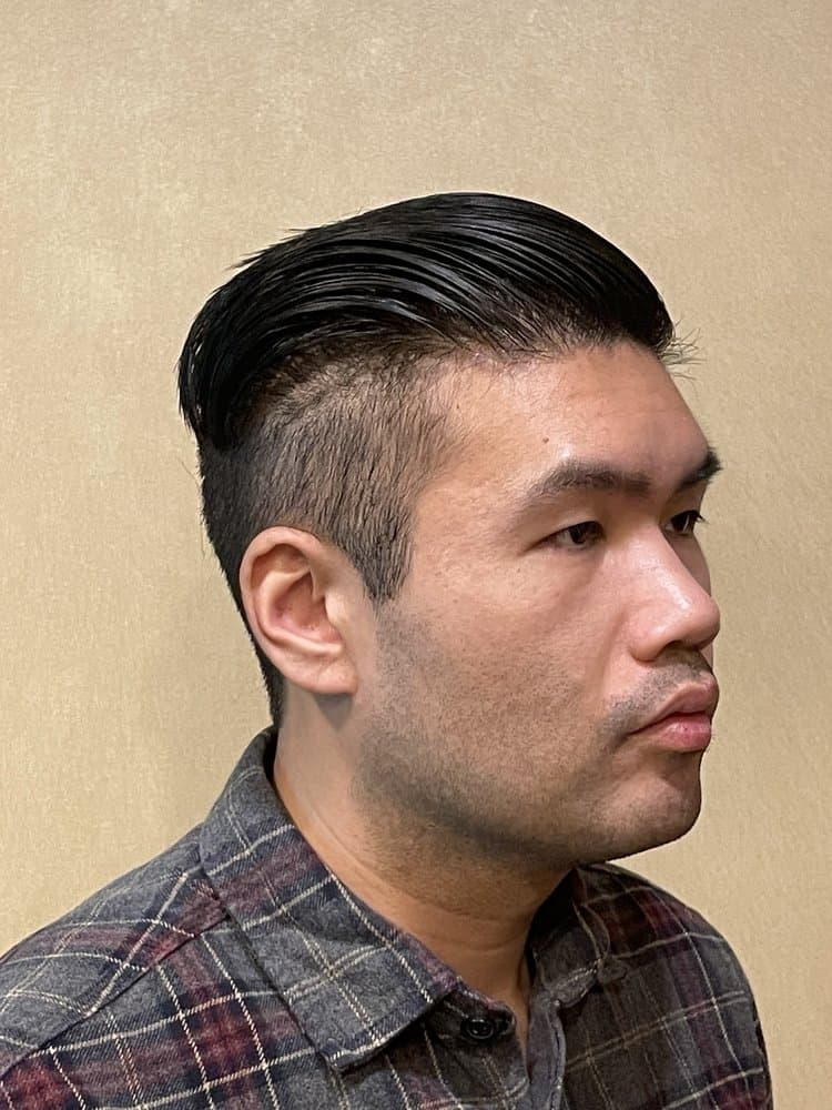 True Dermatology - hair transplant in Anaheim, CA