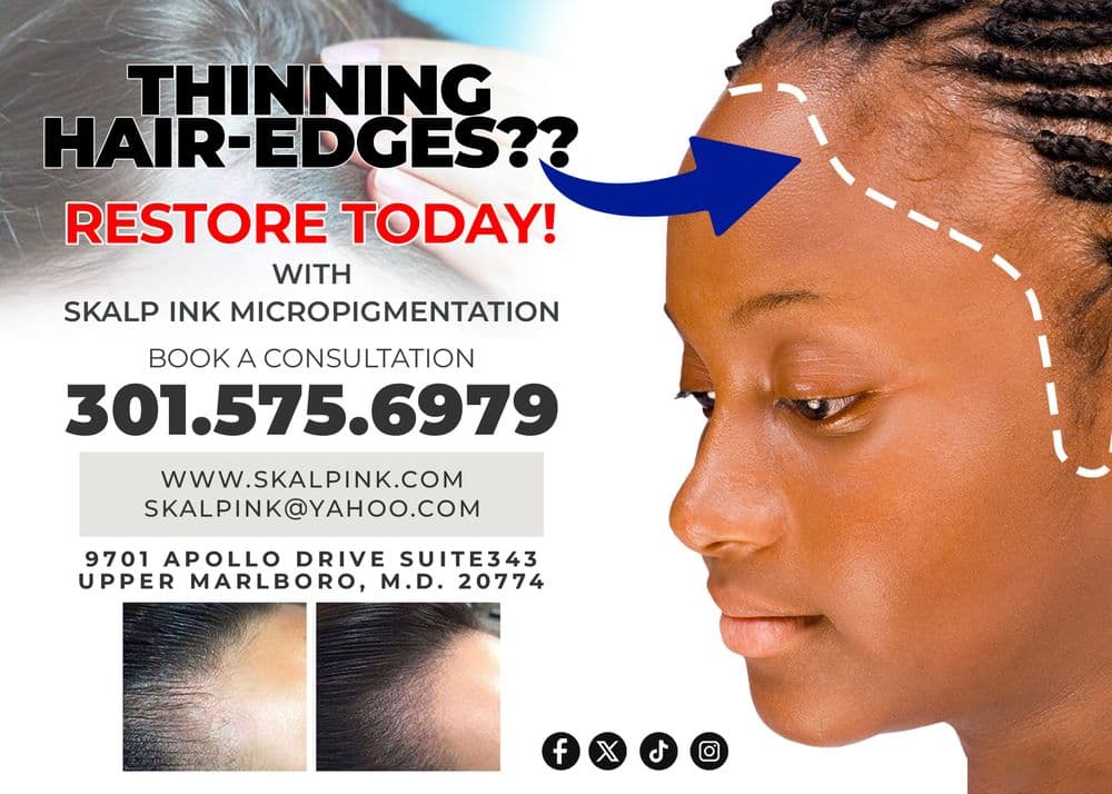 Skalp Ink Micropigmentation - hair transplant in Largo, MD