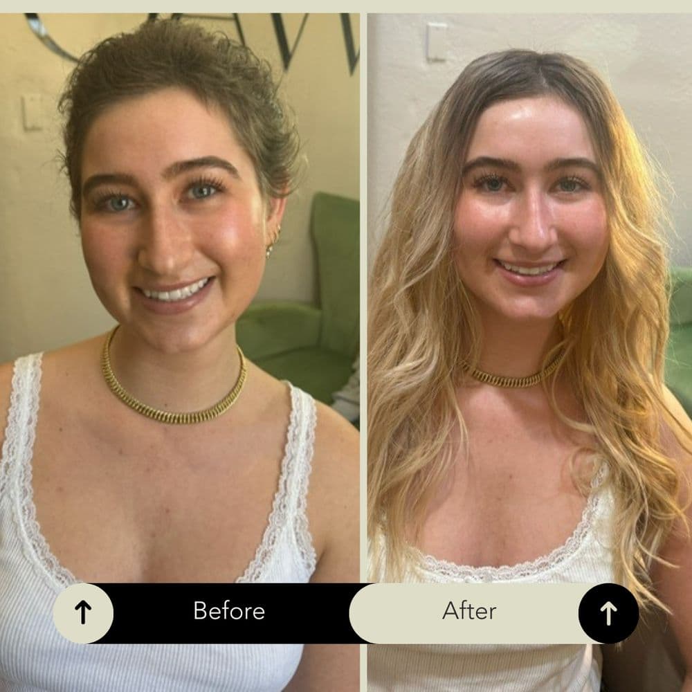 Hair Recovery Treatment Center - hair transplant in Los Angeles, CA