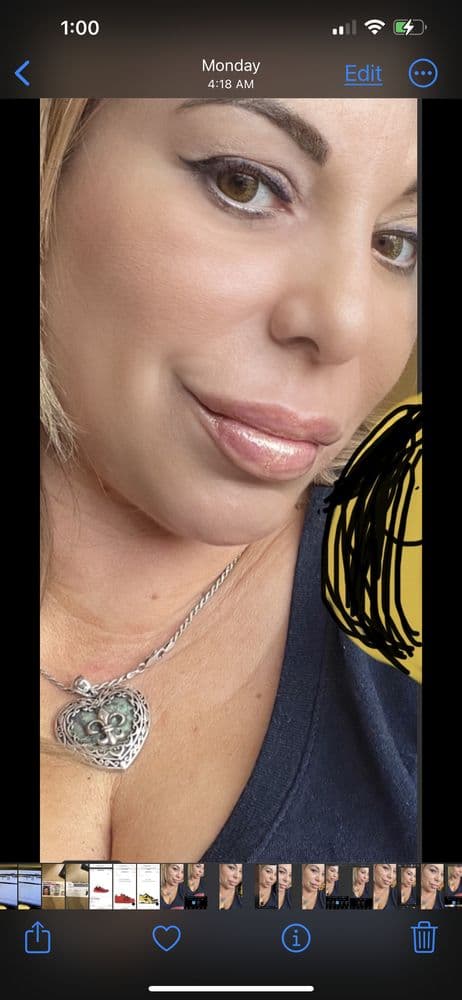 Evolve Med Spa - Short Hills - hair transplant in Short Hills, NJ