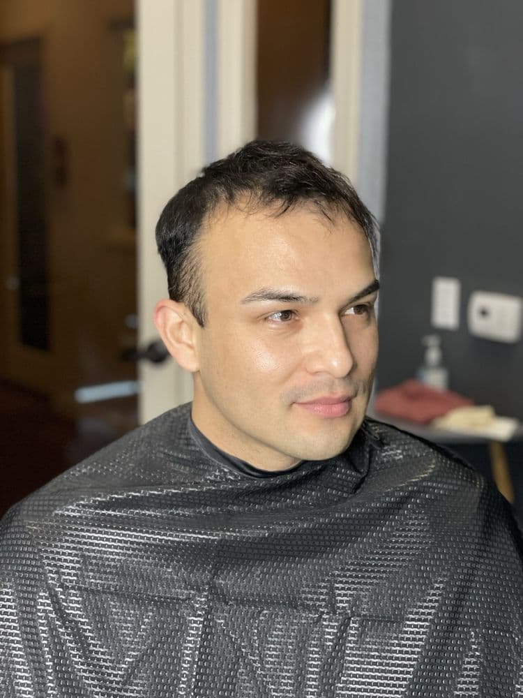 Strandly Hair - hair transplant in Orlando, FL