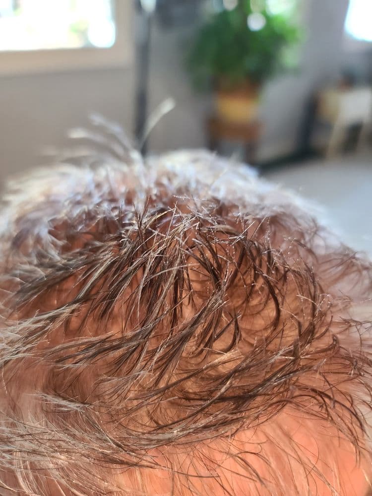 Veronicas hair replacement specialist - hair transplant in North Charleston, SC