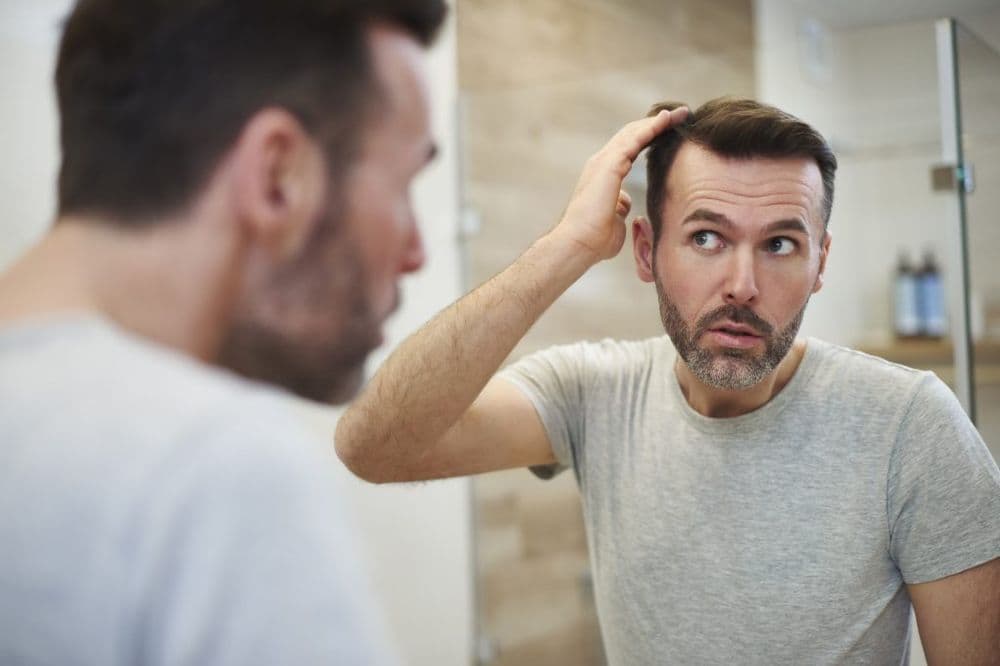 Kurtis Opp - hair transplant in San Francisco, CA