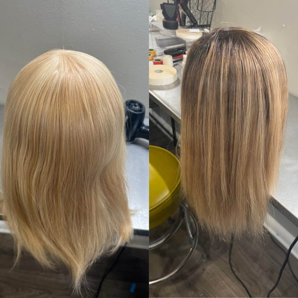 Embassy Studio - hair transplant in Lincolnwood, IL