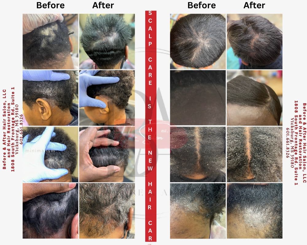 Before & After Hair Salon - hair transplant in Vicksburg, MS