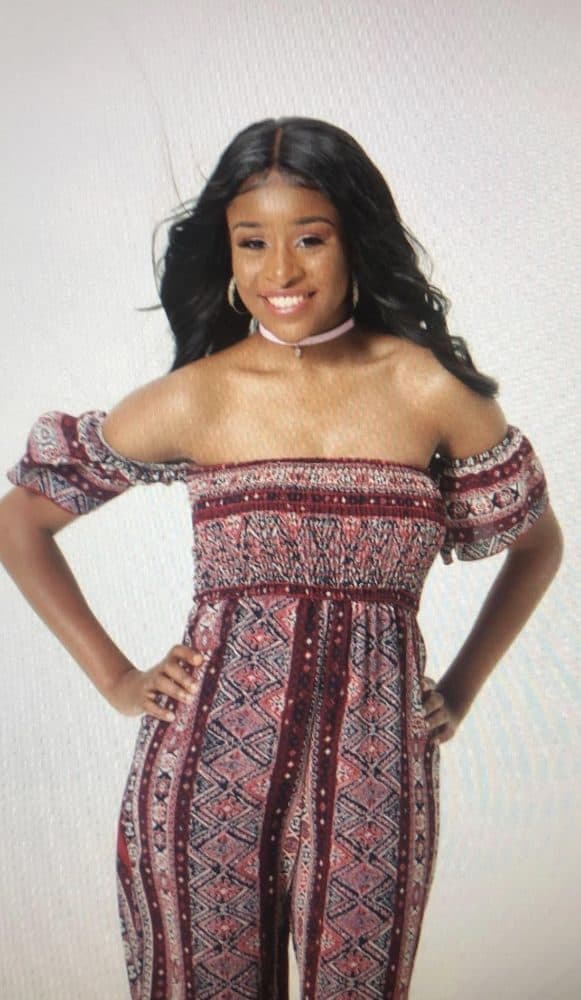 Epitome of London - hair transplant in North Charleston, SC