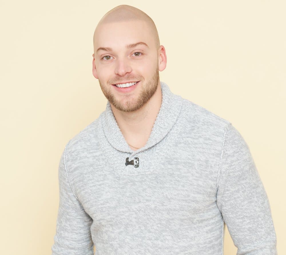 Scalp Micro USA - hair transplant in Houston, TX