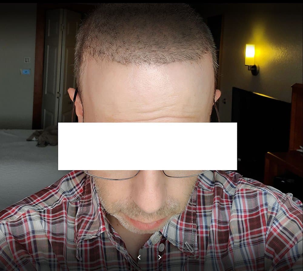 McGrath Medical - hair transplant in Austin, TX