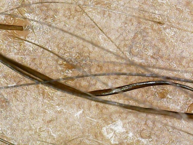 Bold and Beautiful Hair Salon - hair transplant in Downingtown, PA