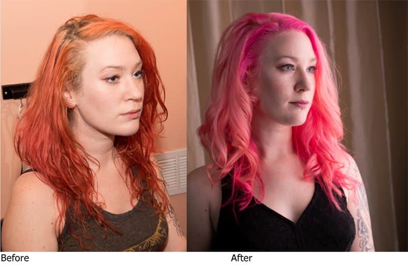 Nuvida Hair Studio - hair transplant in Atlanta, GA