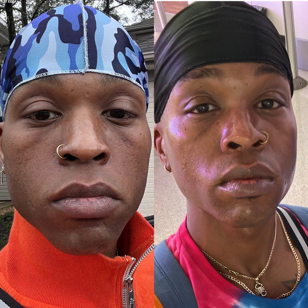 Asha Esthetic - hair transplant in Miami, FL