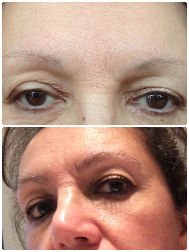 Virginia Surgical Center - hair transplant in Midlothian, VA