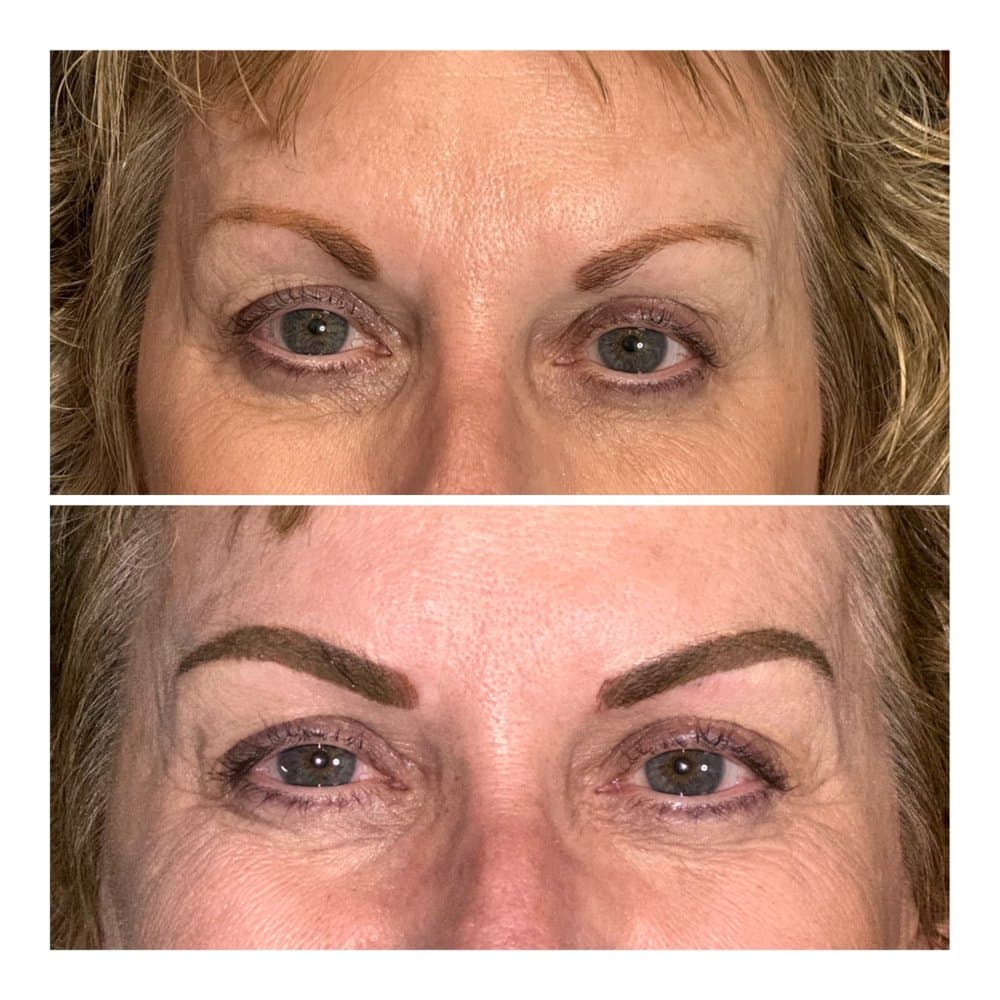 Grand Aesthetics By Donna - hair transplant in Salem, OR