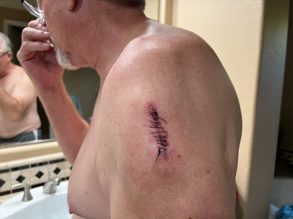 Berman Skin Institute - hair transplant in San Francisco, CA