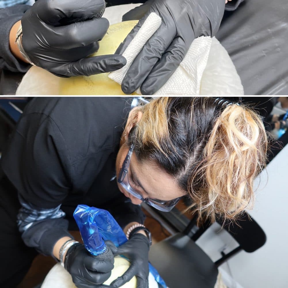 Scalp Studio - hair transplant in San Diego, CA