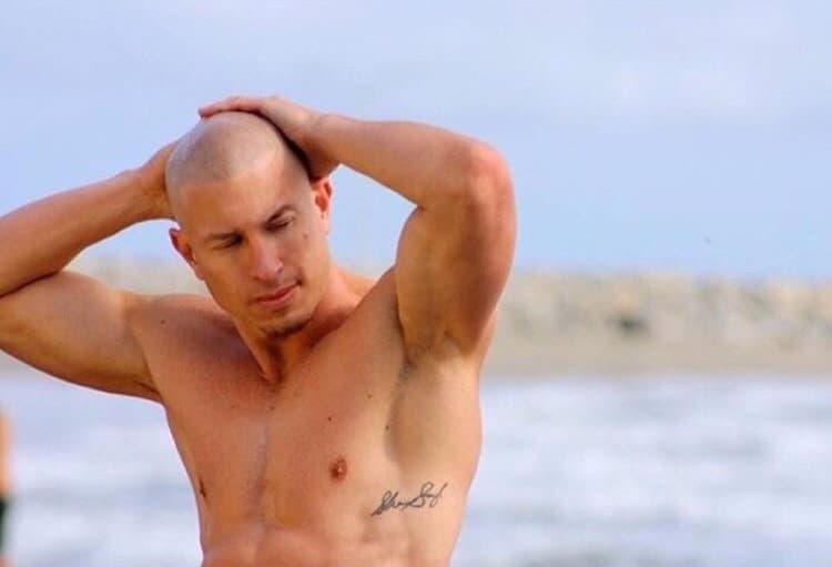 Scalp Symmetry - Scalp Micropigmentation - hair transplant in La Jolla, CA