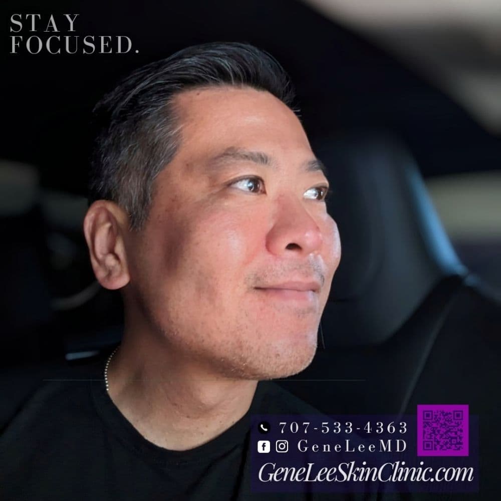 Gene Lee Skin Clinic - hair transplant in San Diego, CA