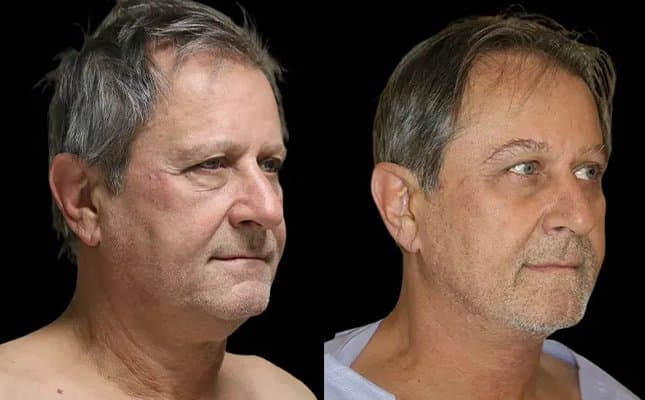 Sahar Nadimi, MD - Chicago Hair Institute - hair transplant in Oakbrook Terrace, IL