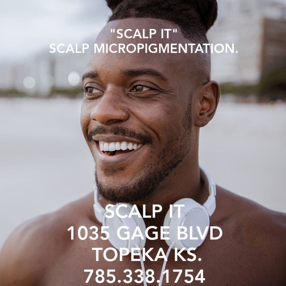 Scalp It - hair transplant in Topeka, KS