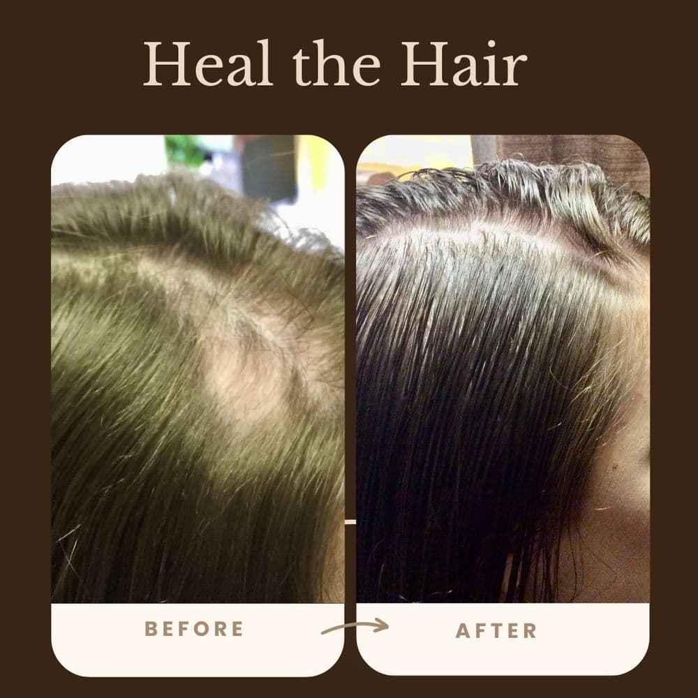 Parker Trichology Centre - hair transplant in Carrollton, TX