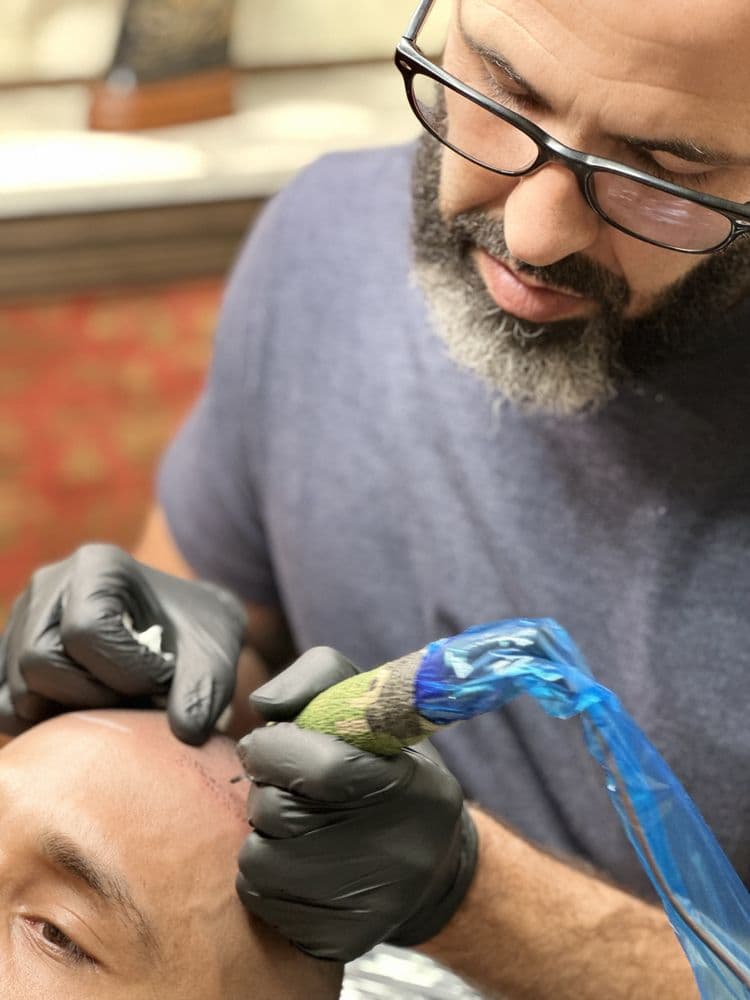 Hair Ink Miami SMP - hair transplant in Virginia Gardens, FL