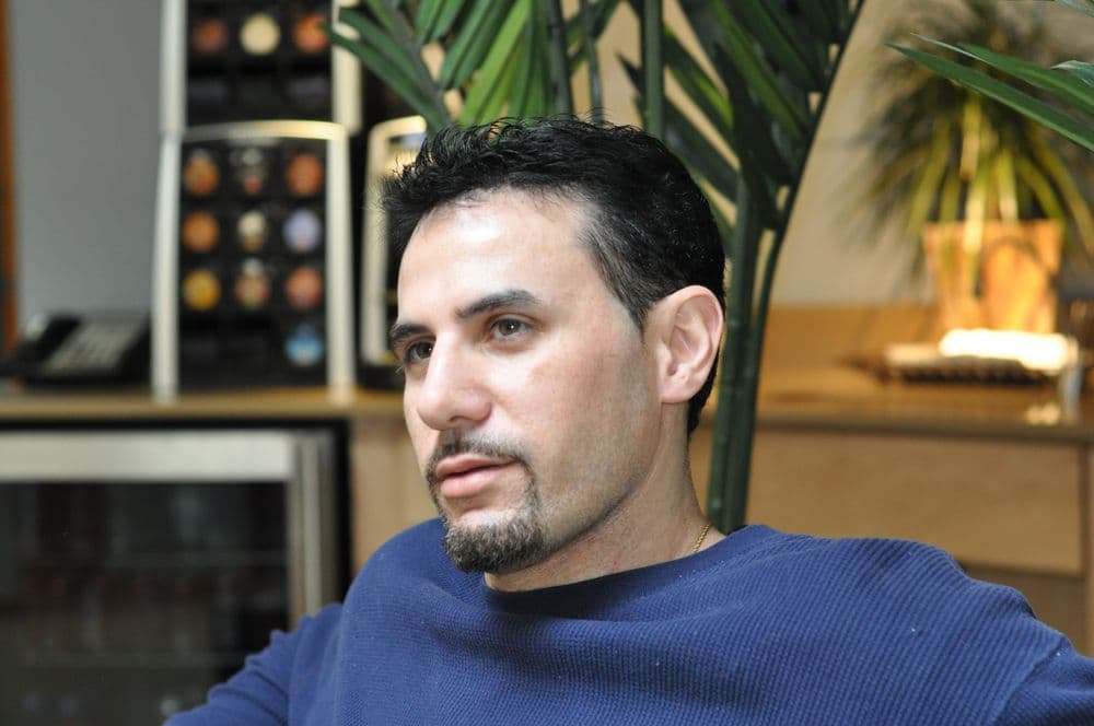 Samson - hair transplant in Chicago, IL