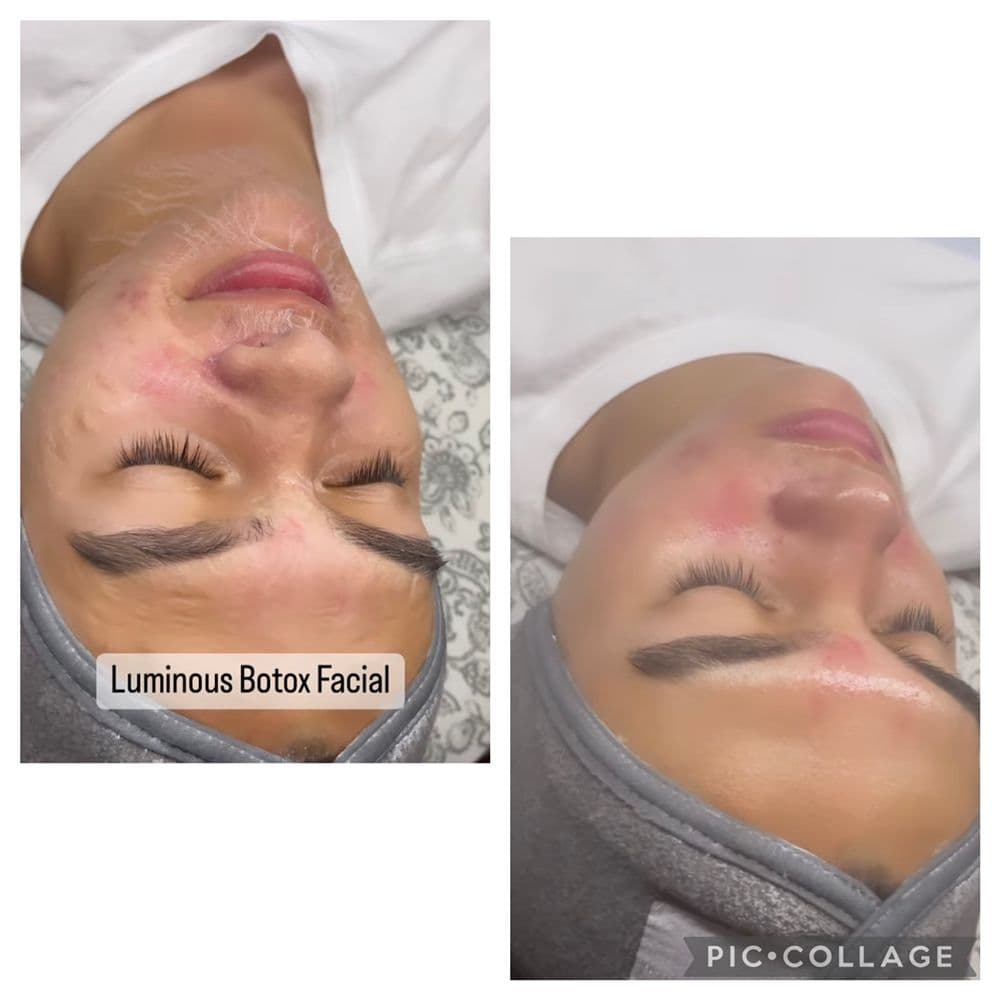 Luminous Skin Studio - hair transplant in Santa Clara , CA