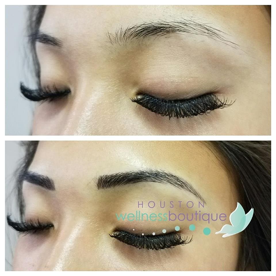 Little Rock Wellness Boutique - hair transplant in North Little Rock, AR