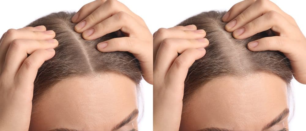 Hair Restoration Group - hair transplant in North Brunswick Township, NJ