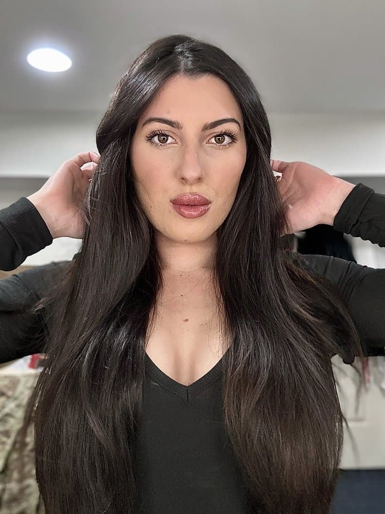 Lumi Aesthetics - hair transplant in Severna Park, MD