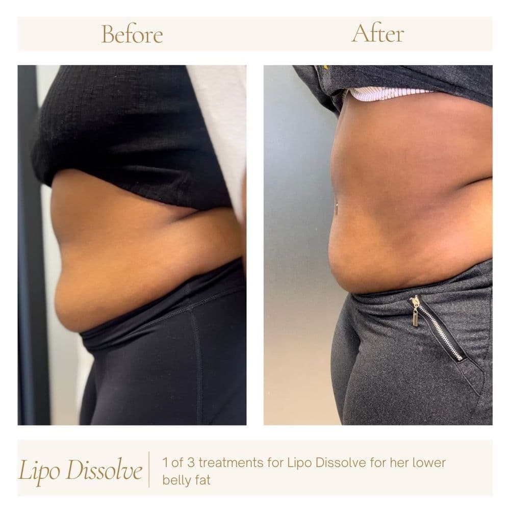 Dream Beauty And Wellness - hair transplant in Troy, MI