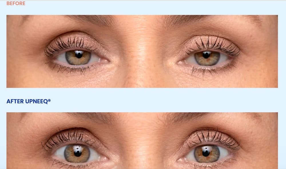 MarSha MedSpa - hair transplant in Garner, NC