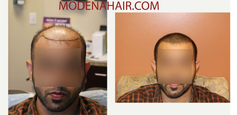 Modena Hair Institute - hair transplant in Henderson, NV