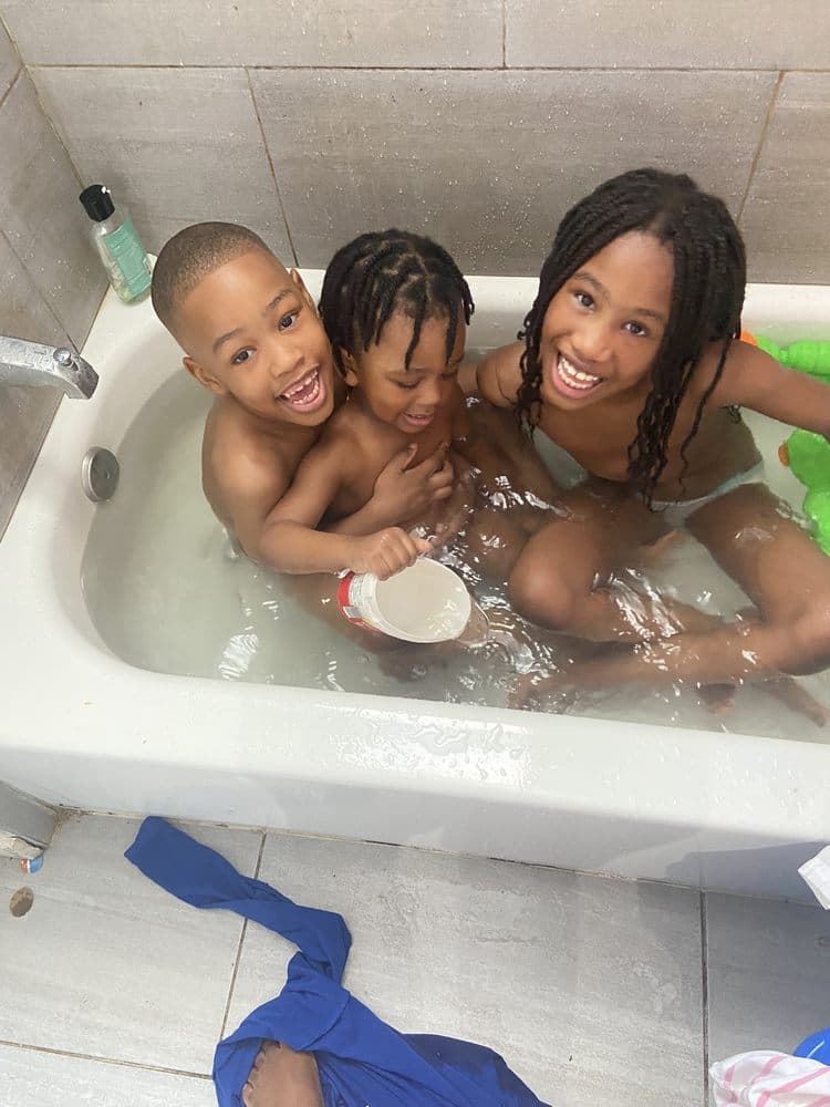 Augustin Family - hair transplant in Irvington, NJ