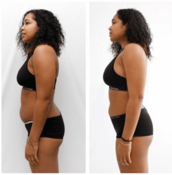 California Aesthetics & Medical Spa - hair transplant in Los Angeles, CA